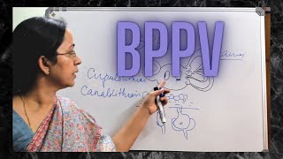 026 Benign Paroxysmal Positional Vertigo BPPV [upl. by Asilram]