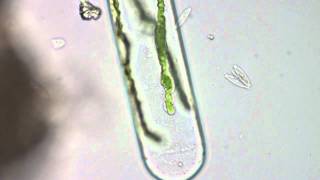 Spirogyra  Filamentous Green Algae [upl. by Kippy]