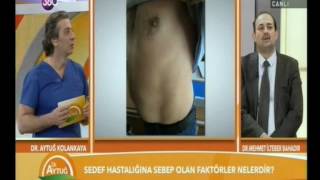 SEDEF HASTALIĞI  DR MEHMET İLTEBER BAHADIR  OpDr Ahmet Tahir ERDEM [upl. by Levon]