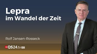 Lepra Die älteste Infektionskrankheit und ihre heutige Relevanz  Unter der Lupe  QS24 [upl. by Aniez]