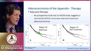 Management of appendiceal cancers From pathology to treatment [upl. by Ilenay]