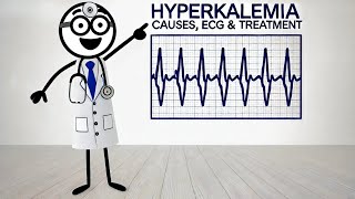 Hyperkalemia Causes pathophysiology ECG features amp treatment [upl. by Carr]