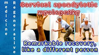 【Regenerative Medicine for Cervical Spondylotic Myelopathy】Amazing Before and After】 [upl. by Namdor]