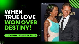 Real story of Turia Pitt and Michael Hoskin [upl. by Nileak]