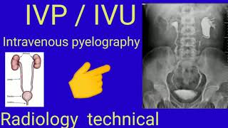 IVP  IVU  Intravenous pyelography  Radiology  Radiography  By BL kumawat [upl. by Wilfred]