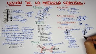 Lesión de la médula cervical  trauma vertebro medular [upl. by Jasmin985]