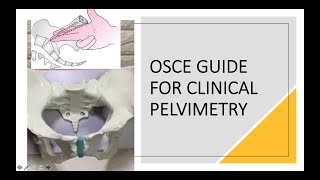 Clinical Pelvimetry [upl. by Behre]