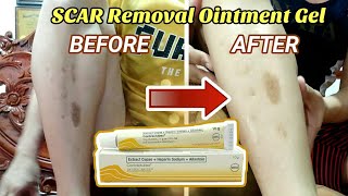 PANTANGGAL NG OLD SCARPEKLAT  Contractubex Ointment Gel REVIEW Explained [upl. by Ruthie]