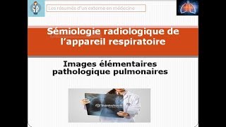 images élémentaires pathologique pulmonaires [upl. by Aicirtam]