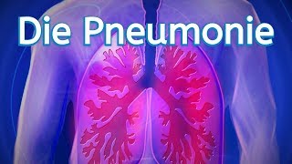 Die Pneumonie [upl. by Leavelle]