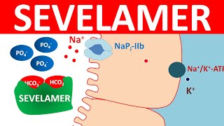 Sevelamer carbonate tablets for elevated phosphate levels [upl. by Palla]