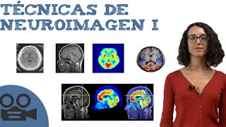 Técnicas de neuroimagen I [upl. by Schurman217]