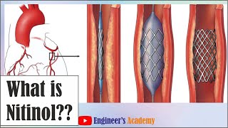 What is Nitinol [upl. by Hgielac27]