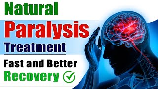 Natural Paralysis Treatment  Fast and Better Recovery  Brain Stroke Recovery  Dr Puru Dhawan [upl. by Latreese421]