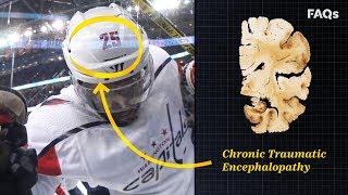 CTE Why this brain disease is more common than you think [upl. by Nnylcaj]