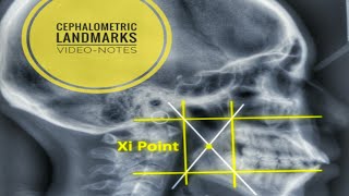 Cephalometric Landmarks and their definition [upl. by Hugo]