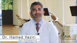 VITIS orthodontic beneficios [upl. by Haneen931]