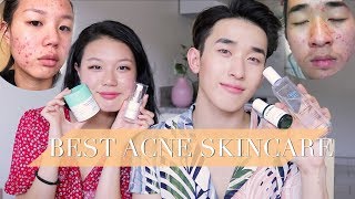 Best Products for ACNE skin ft Hana Lee [upl. by Arres663]