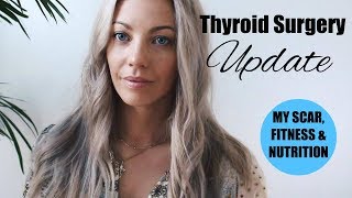 Thyroid Surgery Update  My scar fitness amp nutrition 1 year later [upl. by Vonny]