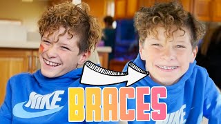 GETTING BRACES FINALLY FOR THE FIRST TIME  SECOND CHILD TO GET BRACES  IDENTICAL TWIN GETS BRACES [upl. by Vanthe]