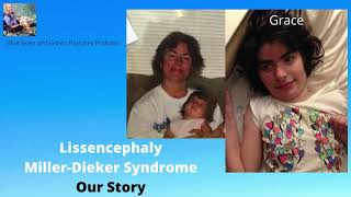 Lissencephaly and Grace Our Story [upl. by Ylrebmic465]