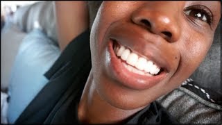 NEW TEETH  GOT MY PERMANENTS Dental Bridge Journey  Part 3 [upl. by Adias]