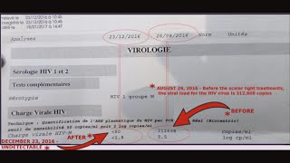 HIV Positive for 25 Years then HIV is GONE  PCR Test Result [upl. by Leonanie]