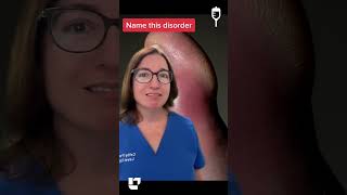 Name this Disorder 9 Medical Surgical SHORT  LevelUpRN [upl. by Aynek]