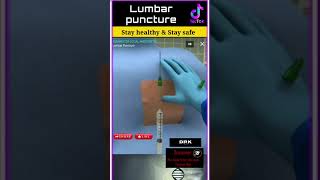 Lumbar puncture [upl. by Annabella605]