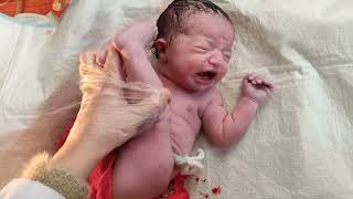 Breech delivery of beautiful newborn baby viral baby [upl. by Elwaine]