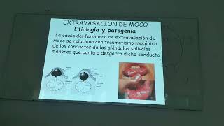 Gastroenterologia teórica Patologias de las glándulas salivales 12032024 [upl. by Annasus]