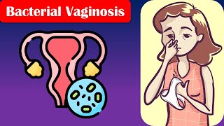 Bacterial Vaginosis  Causes Risk Factors Signs amp Symptoms Diagnosis And Treatment [upl. by Ahsauqal]