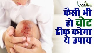 हल्दी सिरका हर तरह की चोट को 100 ठीक करे  How to Heal Minor Wounds at Home [upl. by Ikkin]