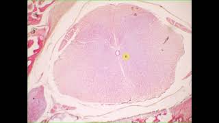 Interneuron sensory neuron pseudounipolar neuron ependymal cells satellite cells Spinal cord amp g [upl. by Kos489]