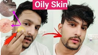 How To Control Oily Skin for MenHindiHow to get rid of Oily Skinऑयली स्किन से छुटकारा [upl. by Elatnahs]