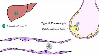 Bacterial Pneumonia  Pathogenesis [upl. by Fita821]