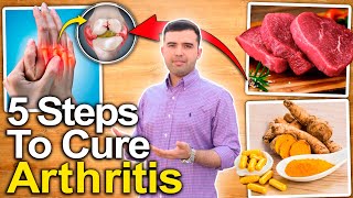 How To Cure Rheumatoid Arthritis and Joint Pain  5 SIMPLE STEPS THAT WORK [upl. by Oramlub]