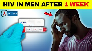 HIV Symptoms in Men After 1 Week [upl. by Adnocahs]