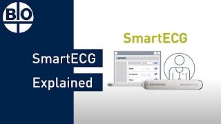 SmartECG Explained How SmartECG Can Help Improve Arrhythmia Detection [upl. by Assenay]