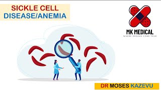 Sickle cell Anemia  SCA  SCD [upl. by Rafat635]