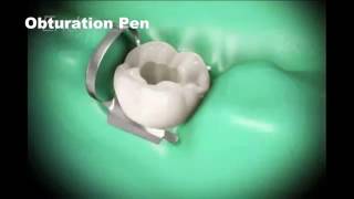 Root canal treatment and Cap [upl. by Sirotek]