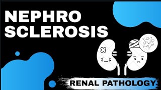 NEPHROSCLEROSIS  Renal Pathology   Med Bees [upl. by Aniat]