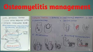 Osteomyelitis management [upl. by Eninaej]