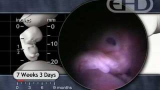 7 Weeks Pregnant  Hiccups amp Startle Response [upl. by Einon]