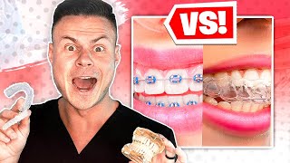 BRACES VS INVISALIGN … Which Is Best [upl. by Narine]