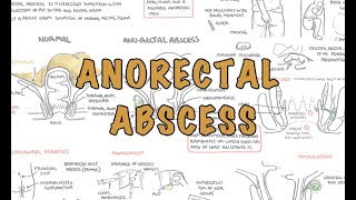 Anorectal Abscess General Surgery  Overview [upl. by Woodson]