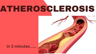 Atherosclerosis in 2 minutes [upl. by Llemar579]