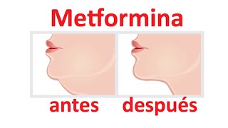 Cómo tomar Metformina para dejar de Roncar [upl. by Morville]