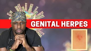 The Truth About Genital Herpes Complete Guide [upl. by Ludmilla]