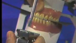 Delivery of Complete Denture  Part 2 [upl. by Iznik410]